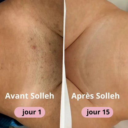 Rasoir SOLLEH®