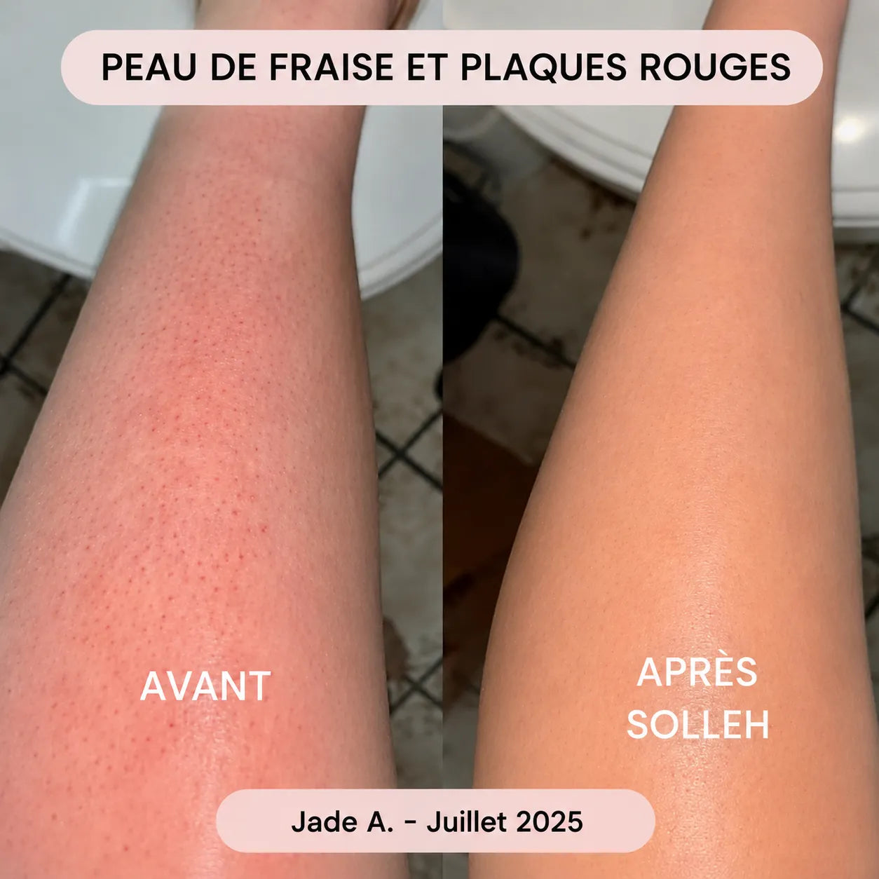 Rasoir SOLLEH®