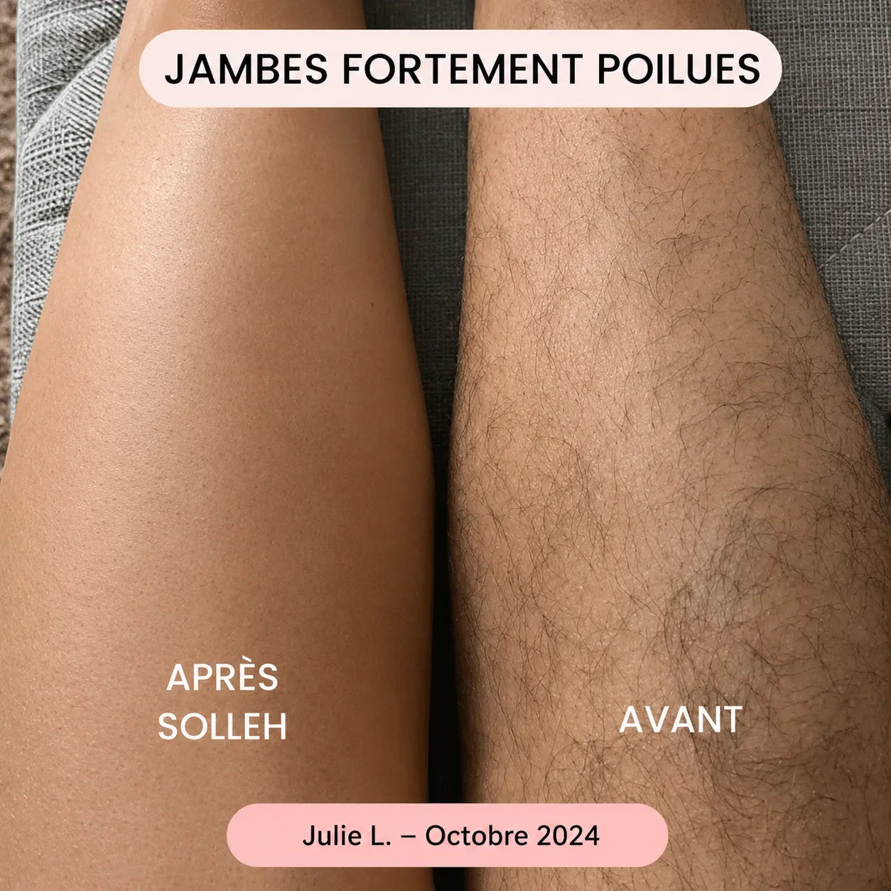 Rasoir SOLLEH®