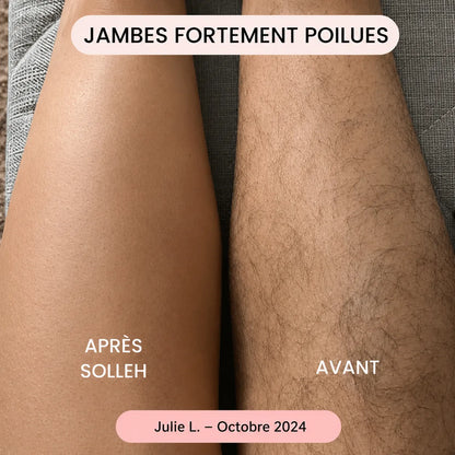 Rasoir SOLLEH®