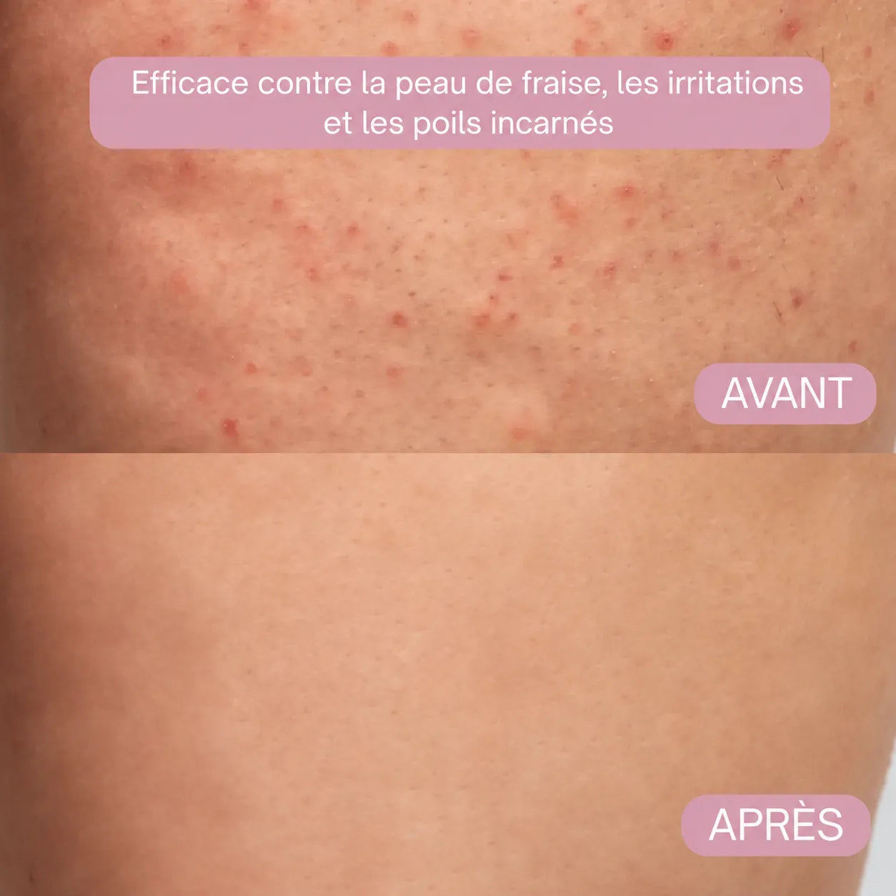 Rasoir SOLLEH®